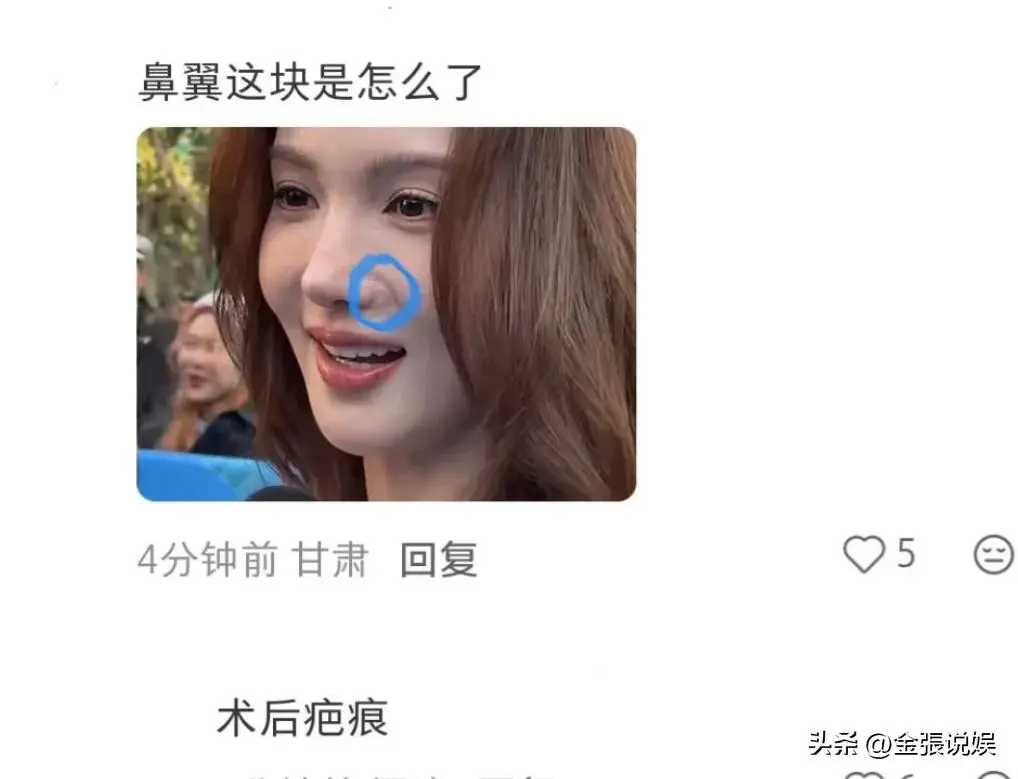 金晨鼻子翻车 高清镜头暴露疤痕 网友质疑演技外貌_女明星脸上有疤痕